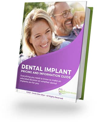 Dental Implant Pricing Guide