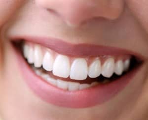 Healthy gums-Beautiful Smile