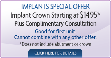 Special Promotion Implants