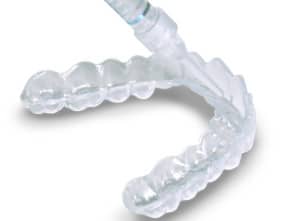 alternatives of tooth whitening glen ellyn wheaton